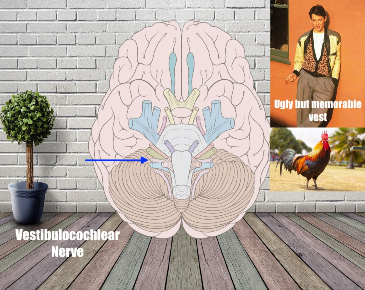 vestibulocochlear nerve mnemonic example